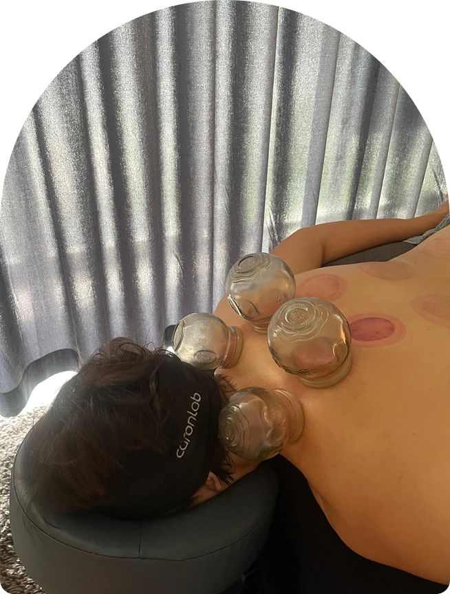 Person receiving a remedial massage with cupping therapy, showcasing glass cups on the back, in a relaxing treatment space with soft lighting and privacy curtains.